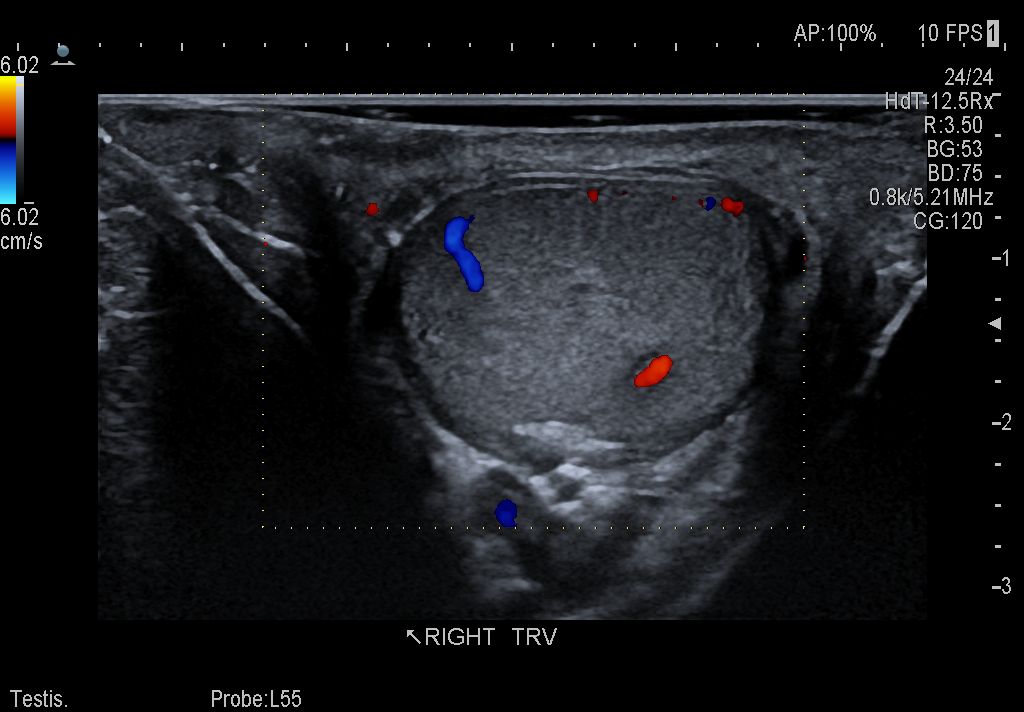 Testis Imaging using the L64 Transducer