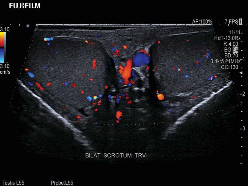 Testis Imaging using the L55 Transducer